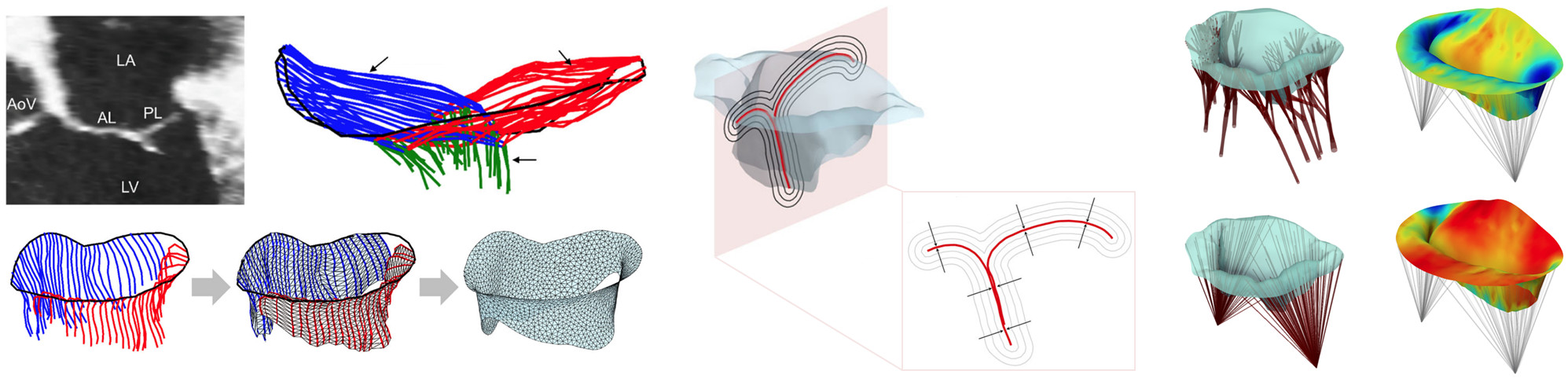 Patient-specific simulations of mitral valve function
