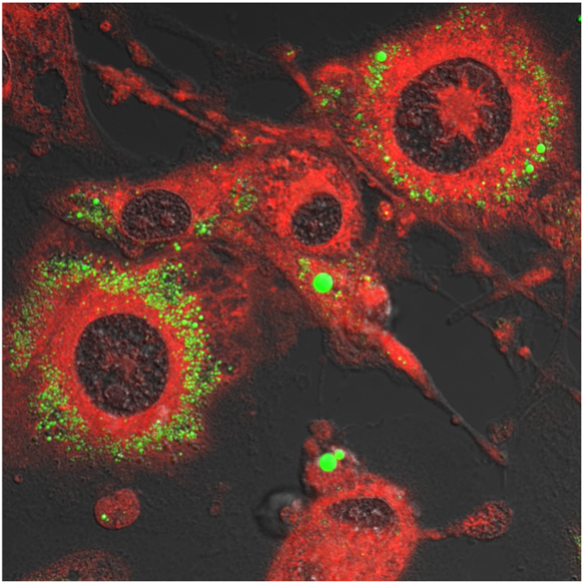 fal cells after terpenoid treatment 